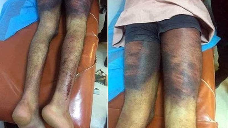 جرائم على أجساد الرجال..