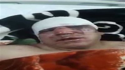 الفيديو.. تفاصيل واقعة الاعتداء على أشهر طبيب قلب في العاصمة الليبية