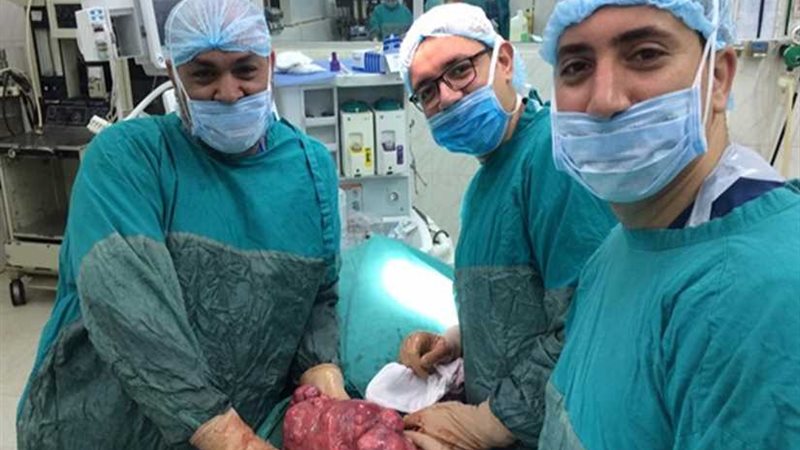 استئصال ورم سرطاني