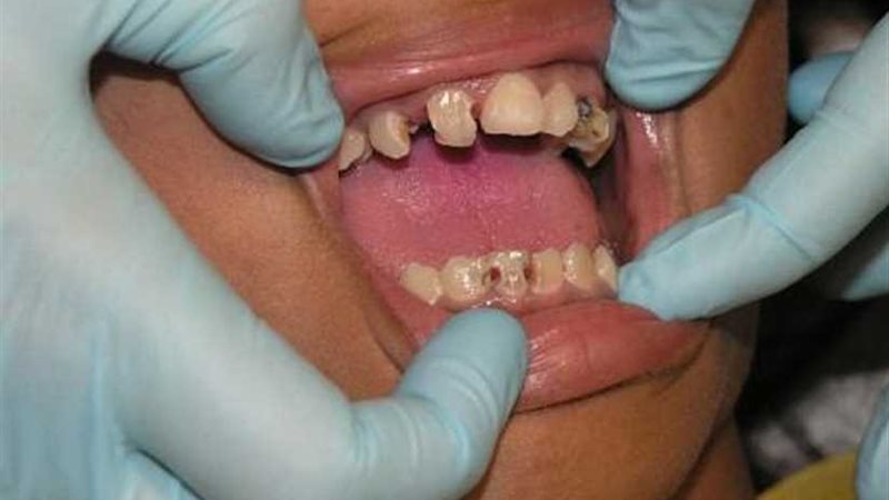 منتشر بكثرة في البلدان