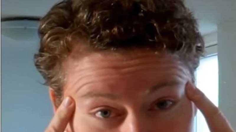 بعد الثلاثين..التجاعيد