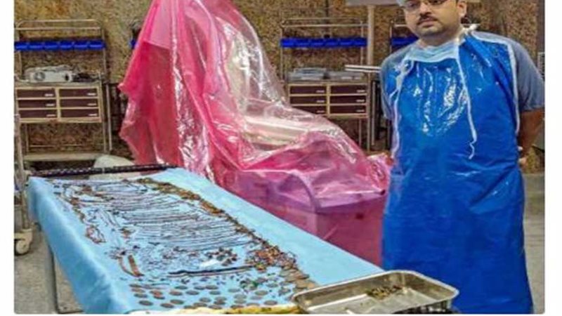 شاهد.. الأطباء يستخرجون