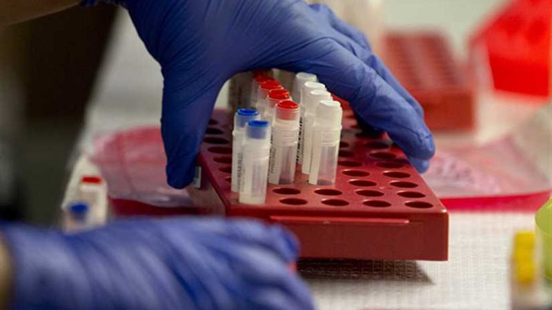 16 إصابة جديدة بمرض