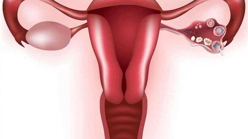 تعرف على أسباب وأعراض