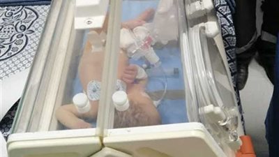 مستشفيات التأمين الصحي ببورسعيد تستقبل أول حالة قسطرة قلبية لطفل عمره ٣ أيام