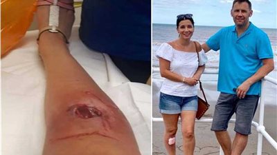 تفاصيل مأساة أم لدغها عنكبوت في حديقتها 