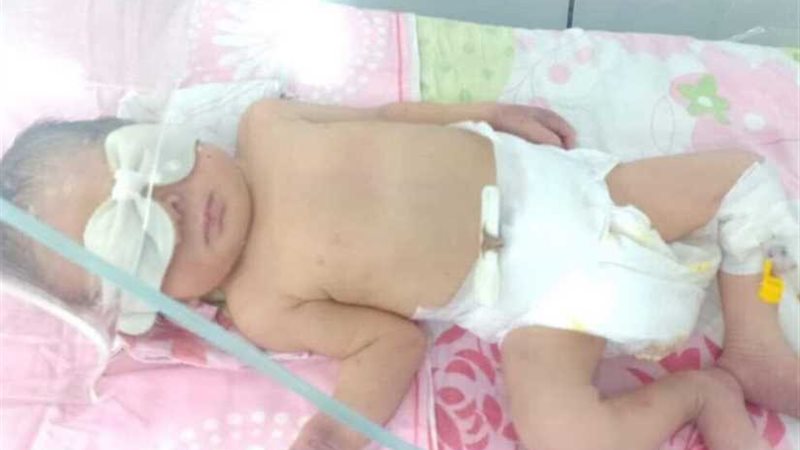 قبل بتر ذراعه..أول