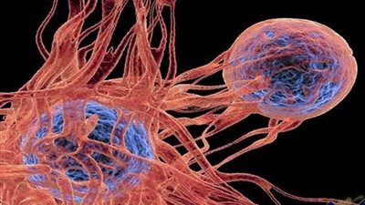 علماء يكشفون سر نمو الأورام السرطانية وانتشارها
