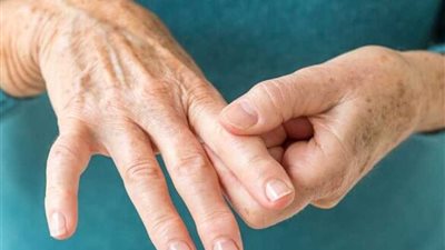 علاج صيني جديد لـ