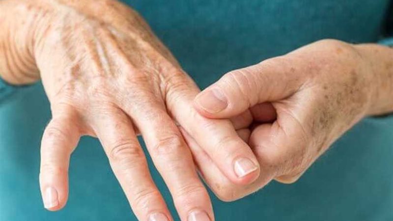 علاج صيني جديد لـالروماتويد