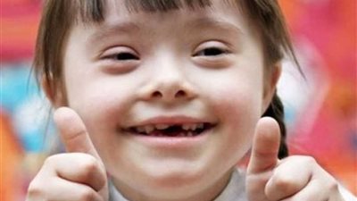 هل هناك رابط بين متلازمة داون وزواج الأقارب