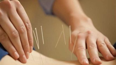 الصين تسعى لعلاج الروماتيزم بالطب الصيني التقليدي