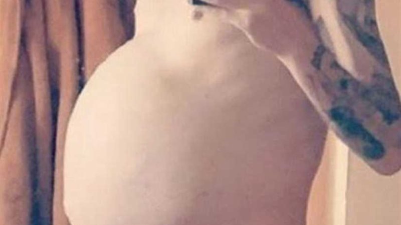 مرض يتسبب في حمل