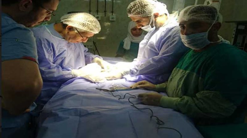 إجراء عمليات التشوهات