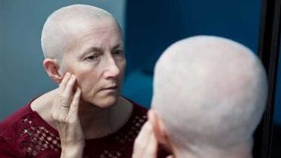 ابتكار عقار يحمي مرضى السرطان من تساقط الشعر أثناء العلاج بالكيماوي