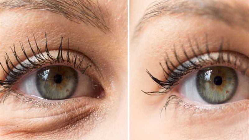 شد منتصف الوجه يستخدم