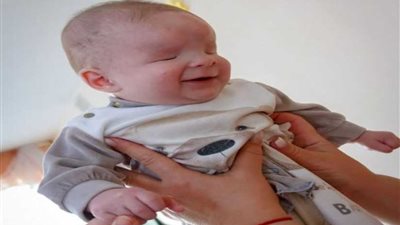 أم تتخلى عن مولودها.. واحد من 3 أطفال في العالم يولدون بلا مقل عيون