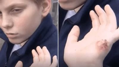 مدرس يعض يد تلميذه.. (فيديو وصور)