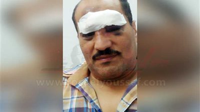 السكة الحديد: إصابة سائق قطار المنصورة بحجر في الرأس وتعيين طاقم آخر لاستكمال الرحلة