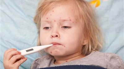 2500 يورو غرامة عدم تطعيم الأطفال ضد الحصبة في ألمانيا