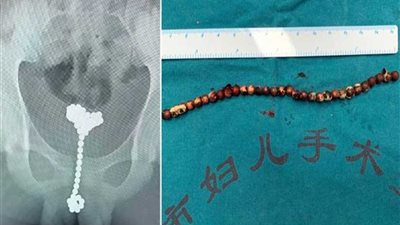 العثور على 31 