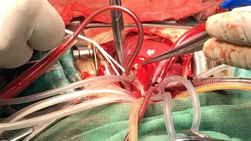 الإسكندرية تستقبل