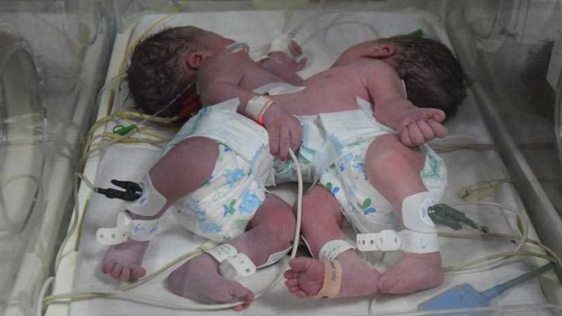 استقرار حالة توءم