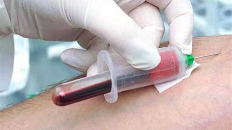 فحص 408 آلاف مواطن