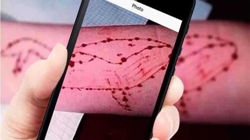 الحوت الأزرق يلتهم