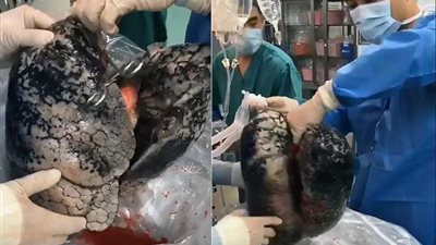 شاهد..جريمة يرتكبها المدخنون في حق أنفسهم