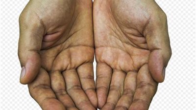 تجاعيد على راحة اليدين يمكن أن تصيبك بمرض خطير