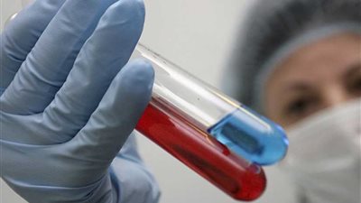 إطلاق لقاح مضاد للإيدز