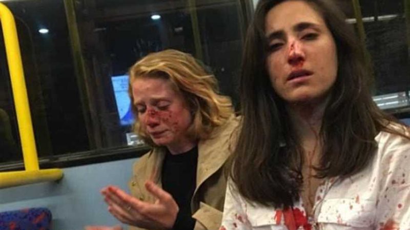 3مراهقين يعتدون على