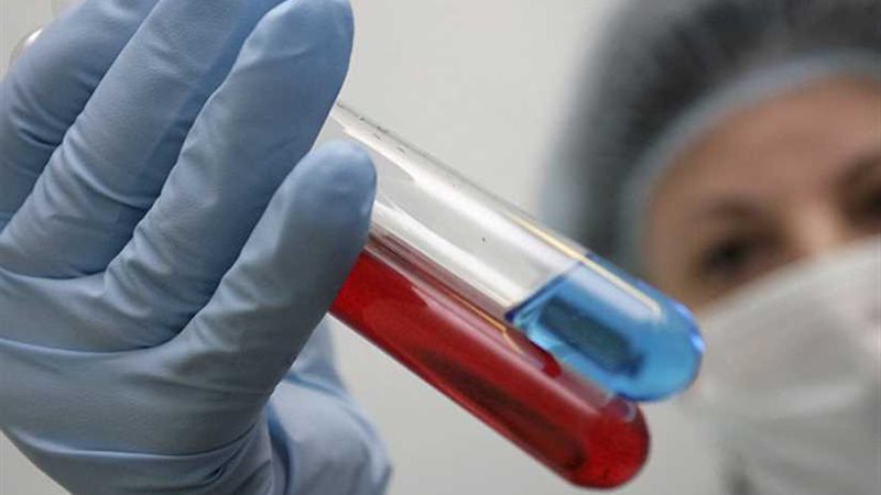 إطلاق لقاح مضاد للإيدز