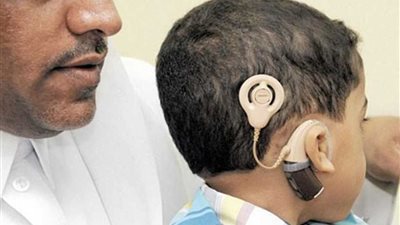 أجهزة تعويضية وأطراف صناعية من الأورمان لغير القادرين في القاهرة والمحافظات