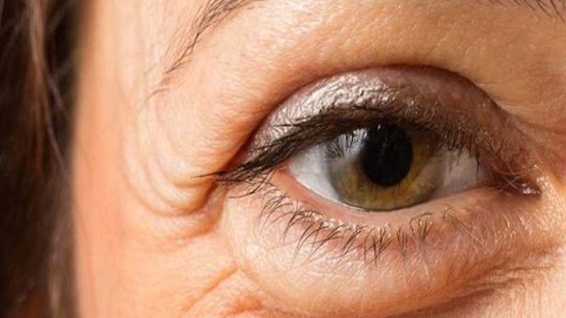 ١٠ علاجات طبيعية