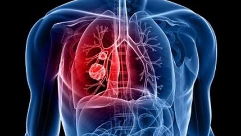 ٣ طرق للوقاية من