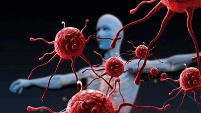 دراسة: روتين يومي مدته 20 دقيقة يحمي من 7 أشكال قاتلة من السرطان!