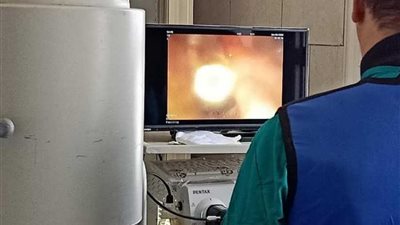 صحة أسيوط: إجراء 4 عمليات تكميم معدة وأول منظار قنوات مرارية