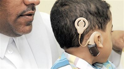أجهزة تعويضية وسماعات طبية من الأورمان لغير القادرين بالمنيا