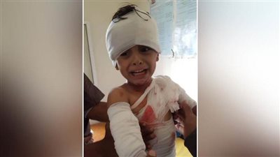 إصابة طفلين يمنيين جراء قصف حوثي بمحافظة البيضاء