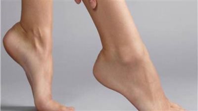 استشاري: الأشعة التداخلية علاج مثالي لدوالي الساقين بدون جراحة