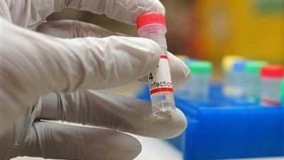 الحكومة السودانية تعلن ؤ من وباء الكوليرا