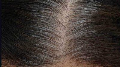 تعرف على السبب الحقيقي وراء تحول شعرك إلى اللون الرمادي