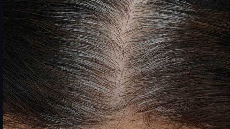 تعرف على السبب الحقيقي