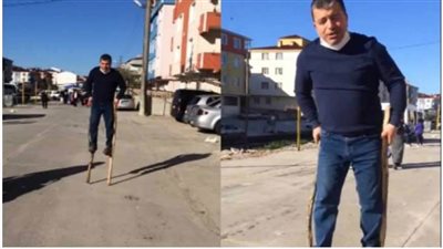 بعد علاجه  ب 