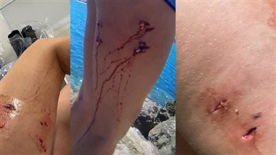  شاهد.. سباع البحر تهاجم فتاة 