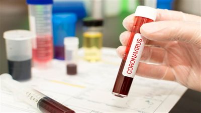  دواء مضاد لالتهاب المفاصل قد يعالج كورونا