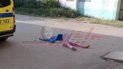 صحة شبين القناطر توضح حقيقة إصابة مريضة كبد بـ