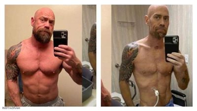 شاهد.. تأثير كورونا المفزع على الجسد الرياضي المصاب